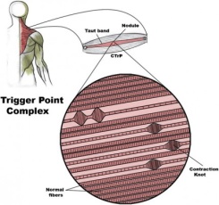 Canine Trigger Point Chart